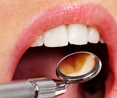 General Dentistry in Marco Island